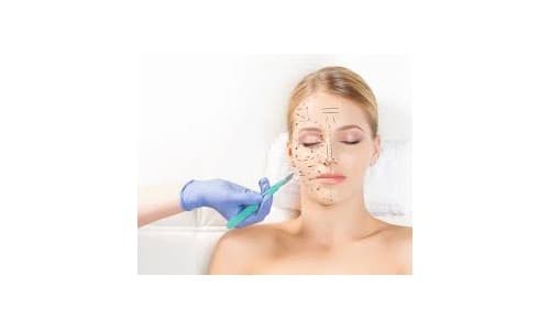 Facial Procedures