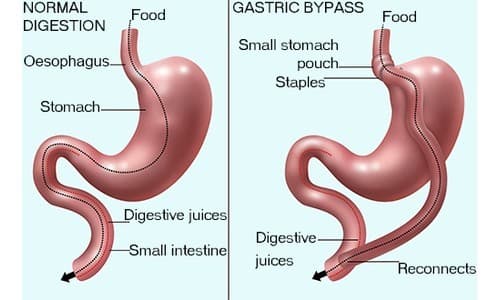 Gastrointestinal Surgery